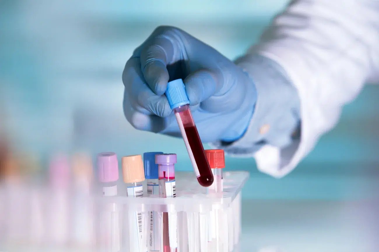 medical employee moving vials of blood for testing